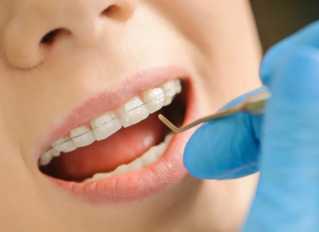 The benefits of preventive dentistry