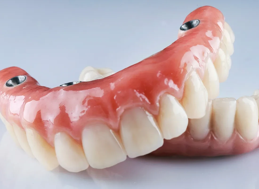 For National False Teeth Day, Get Yourself Dental Implants Instead!