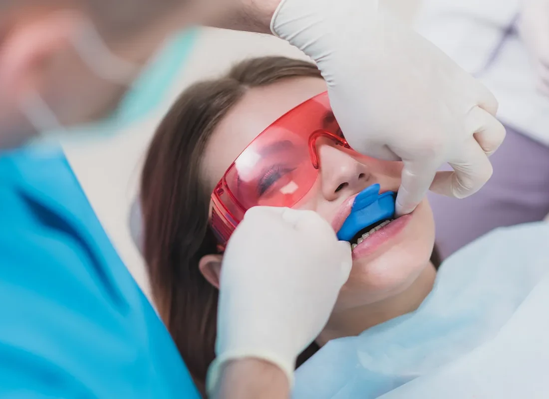 Signs you may need fluoride treatments