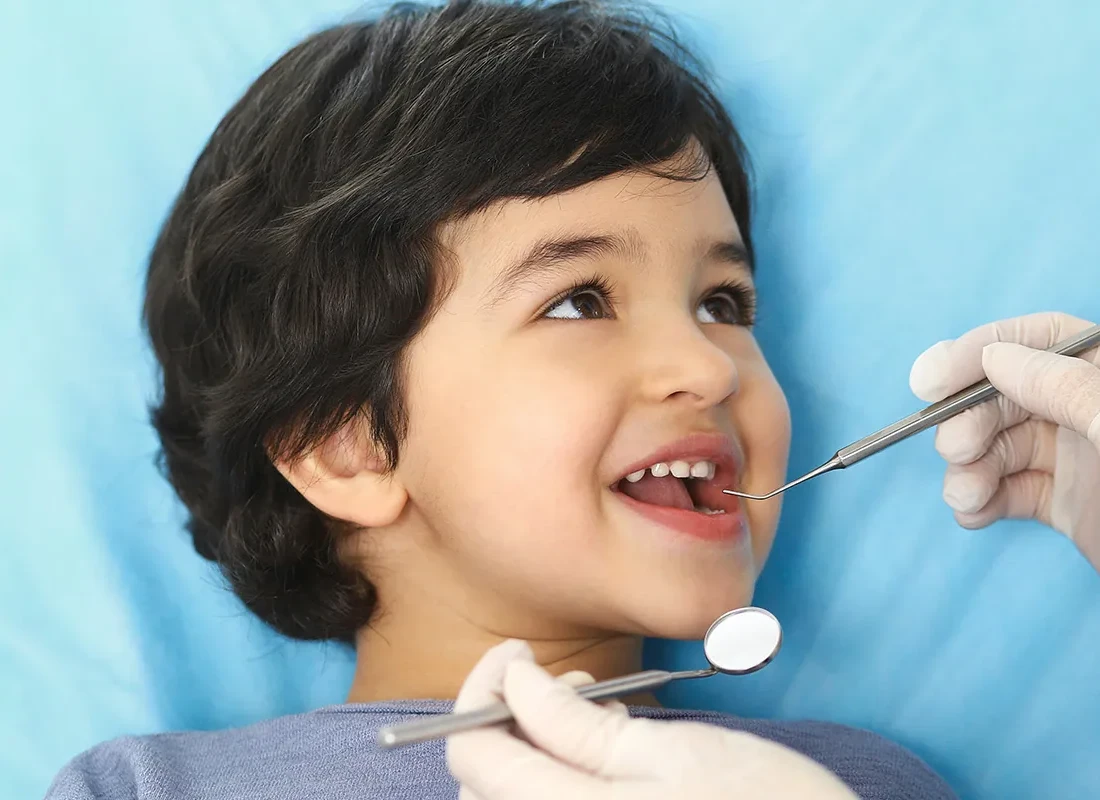 Signs you may need dental sealants