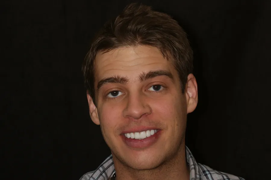 Aaron's smile transformation at Rod Gleave, DMD, after, portrait