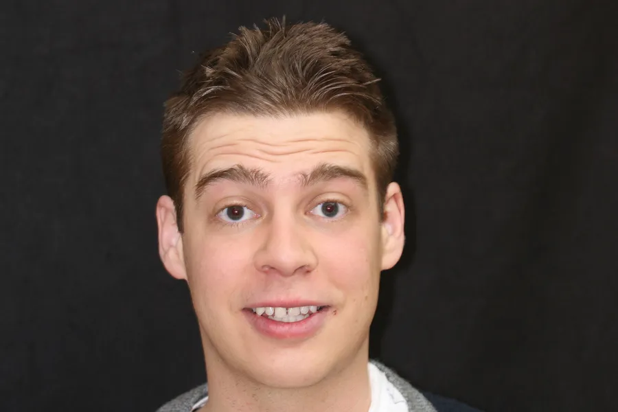 Aaron's smile transformation at Rod Gleave, DMD, before, portrait