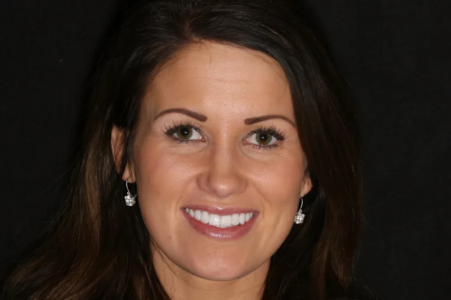 Brittany's smile transformation at Rod Gleave, DMD, after, portrait
