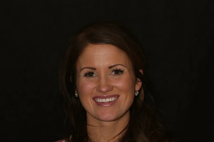 Brittany's smile transformation at Rod Gleave, DMD, before, portrait