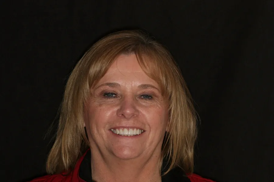 After, 8 Porcelain Veneers: Diane