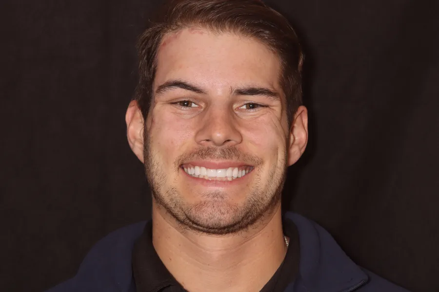 After, 8 Veneers + 2 Esthetic Crowns: Eric