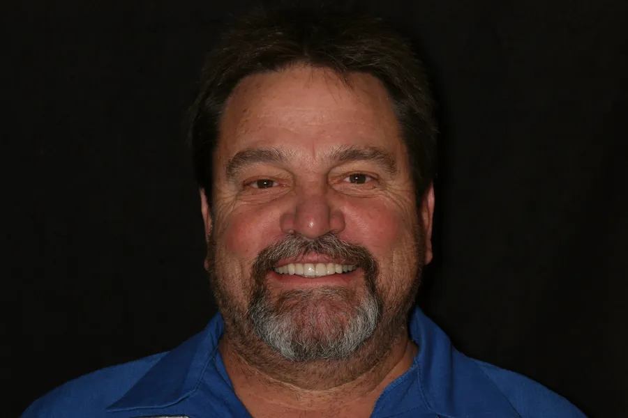 After, 4 All-Porcelain Crowns: Geoff