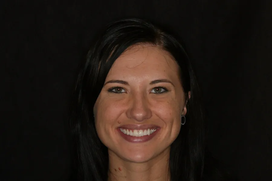Kristy's smile transformation at Rod Gleave, DMD, after, portrait