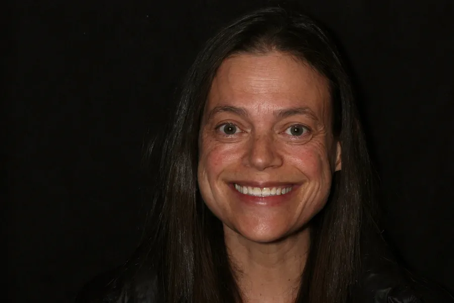 Before, 8 Porcelain Veneers: Pam