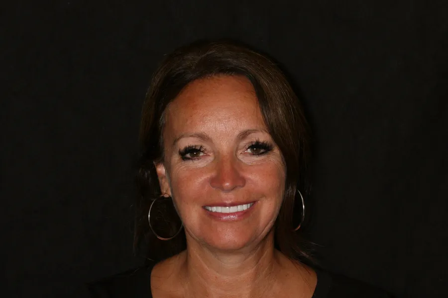 Sharon's smile transformation at Rod Gleave, DMD, after, portrait