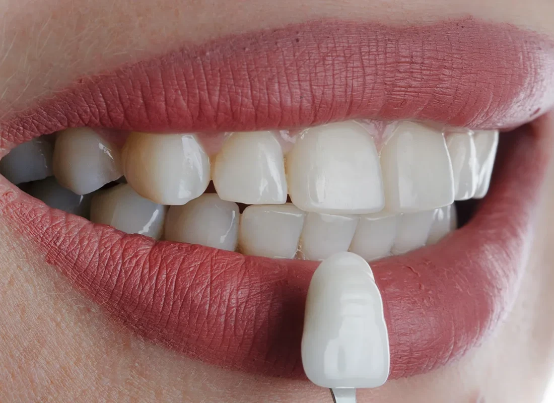 Cosmetic Dentistry To Make You Smile Again!