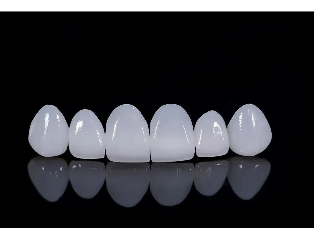 Will The Crowns And Bridges Procedures Restore The Look Of My Smile?