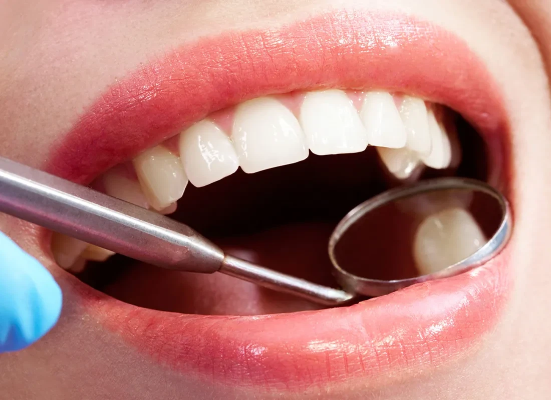 What is Dental Exams & X-Rays