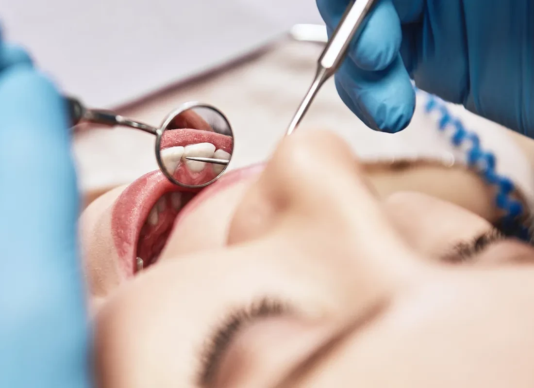 Periodontal Therapy at Rod Gleave, DMD