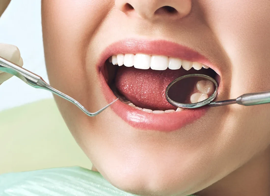 What Is a Root Canal and Does It Hurt?