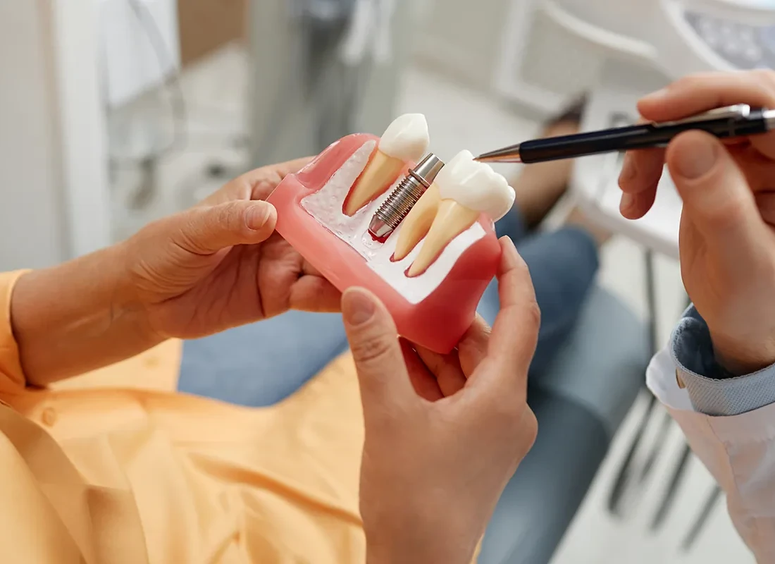 What Is An Abutment For Dental Implants?