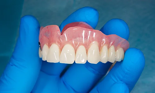 Conventional Dentures
