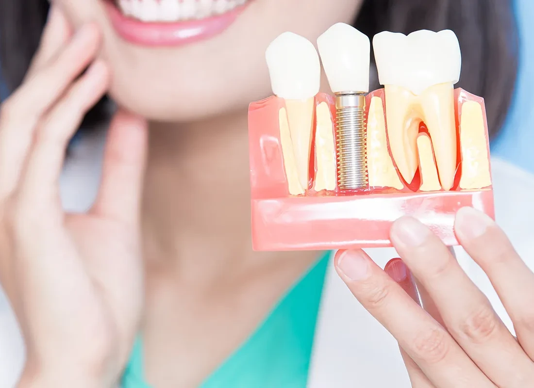 What is Zirconia Dental Implants