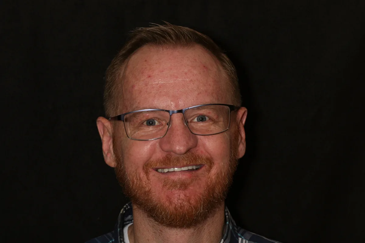 After, 12 Porcelain Veneers: Brad