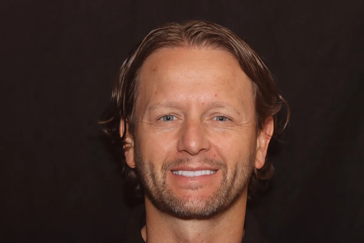 After, 18 Veneers + 2 Esthetic Crowns: Clint