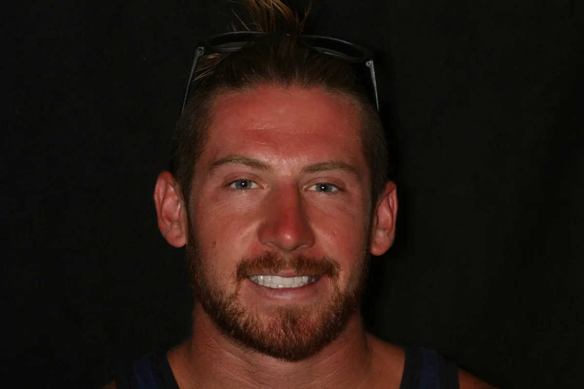 Jon's smile transformation at Rod Gleave, DMD, after, portrait