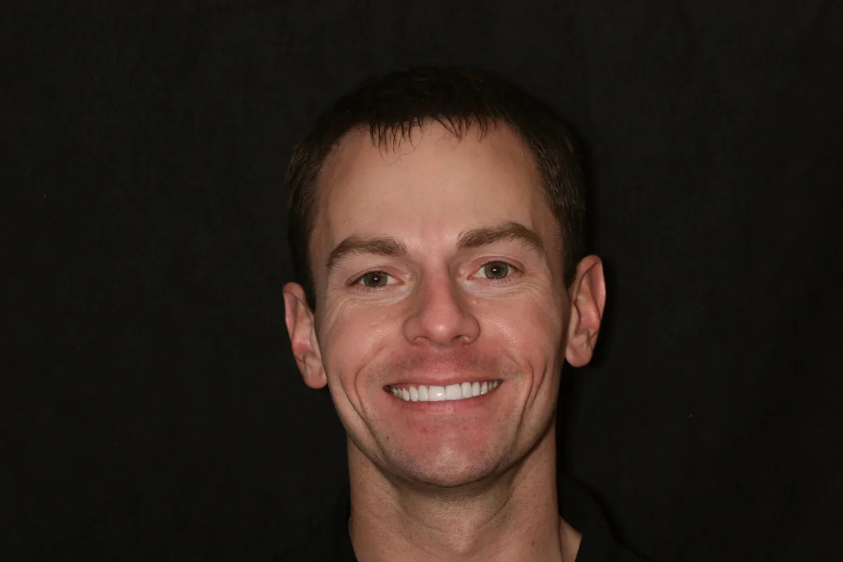 Kenny's smile transformation at Rod Gleave, DMD, after, portrait
