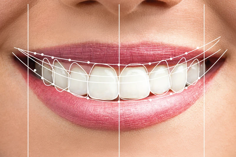 Exceptional Cosmetic Dentistry