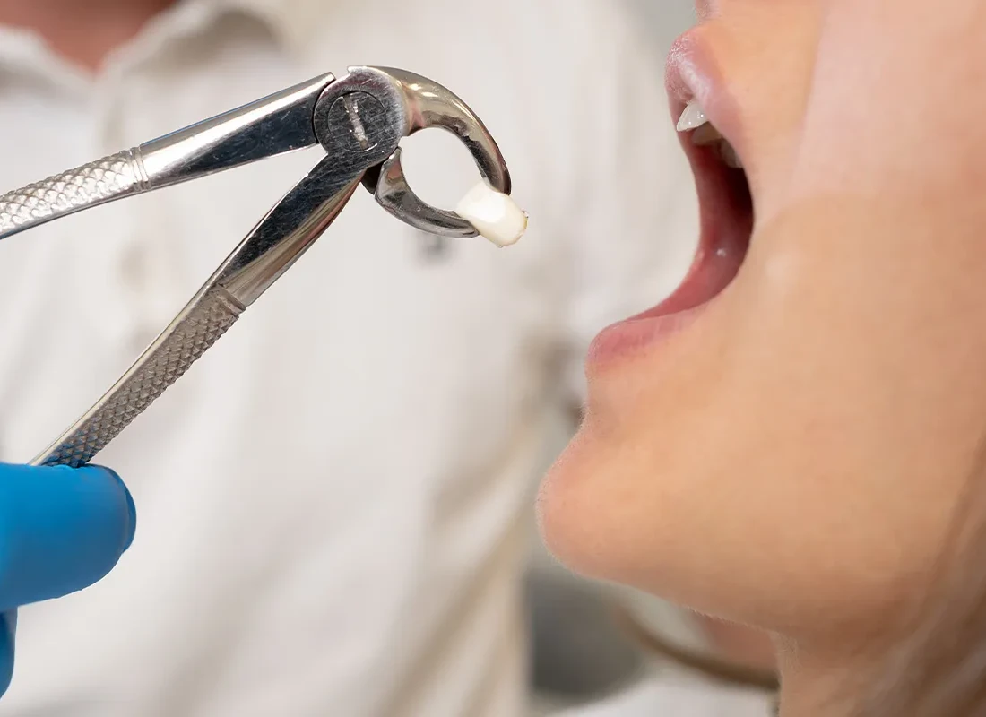 The benefits of oral surgery