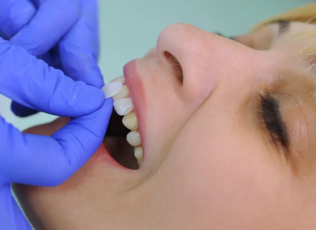 What is cosmetic dentistry