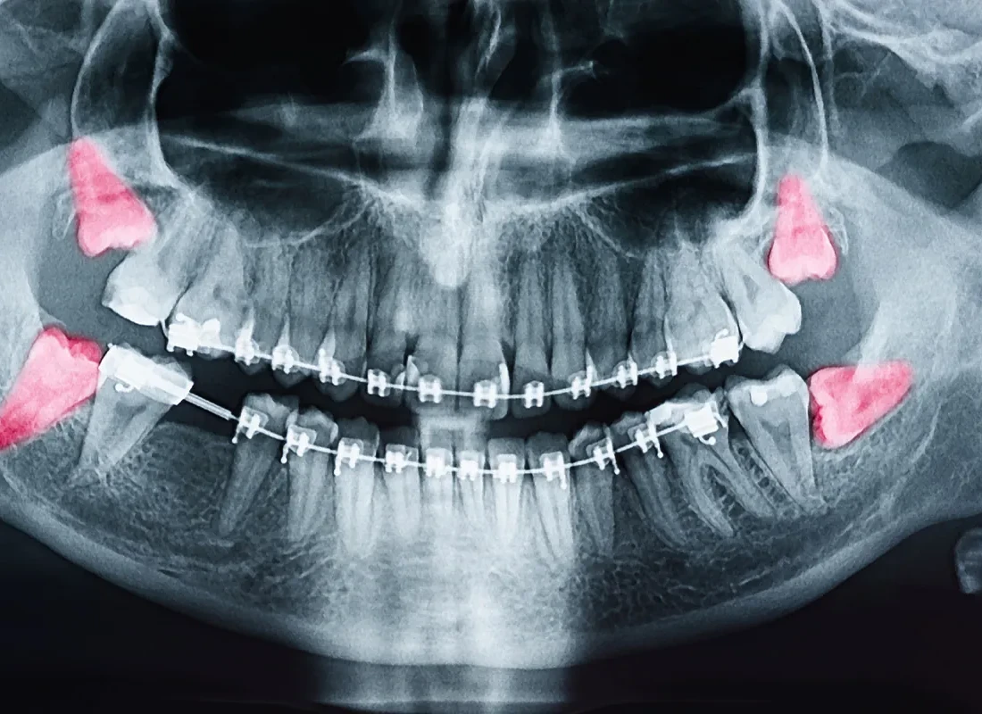 What is oral surgery