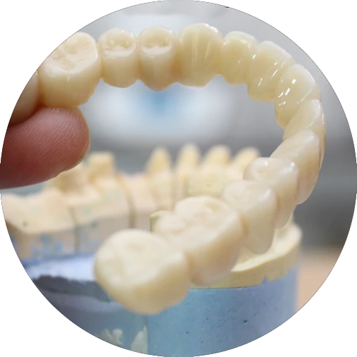 How Can Zirconia Dental Implants Help Me In Salt Lake City, UT?